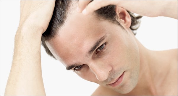 DHI haartransplantatie tegen kaalheid